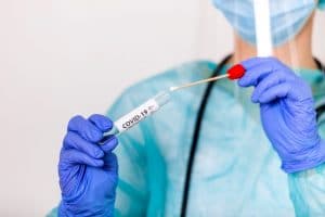 prueba test pcr covid sangre capilar resultado minutos